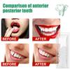 CALANDIS 1 Tooth Repair Kit DIY Tooth Filling Thermal Beads Temporary Teeth Repair Moldable 10G view 3