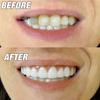 MYADDICTION Silicone Smiling Braces Upper False Teeth Veneers Cosmetic Tooth Cover Health & Beauty | Oral Care | Whitening view 4