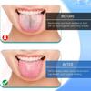 Elecsera Oral Dental Tongue Cleaner/Scrapper Antimicrobial Optimal Oral Hygiene Dental Tongue Cleaner cleaner for kids tongue Pack Of 4 view 2