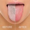 Elecsera Oral Dental Tongue Cleaner/Scrapper Antimicrobial Optimal Oral Hygiene Dental Tongue Cleaner cleaner for kids tongue Pack Of 4 view 3