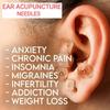 Acupuncture Ear Press Needle for Arthritis (Size - 0.22 x 1.5mm, Press Handle, Pack of 100, Silver) view 3