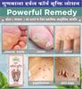 Gunmala Herbals Corn Mukti Lotion - 10 Ml. (For Foot Corns Remover) view 4