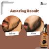 BBest Beard Growth Oil  30 ml Pack of 3) | With Redensyl & 15 Natural Oils Including Jojoba, Almond & Vitamin E | Boosts Beard Growth, Strengthens Hair & Nourishes Roots | No Harmful Chemicals view 3