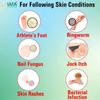 IAFA Ayurvedic AF-7 Cream 50gms- Natural cure for Fungal infections | Fast Relief from Ringworm, Skin infections, Jock itch, Anti chafing, Intimate area itching, Skin rashes, Skin allergy | Anti Itching | Irritation | For All skin problems | Daad khu view 3