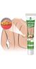 SEINON'S Lipoma Removal Cream Portable for Whole Body Ointment Health Personal Care Skin Care Wide Applications Herbal Ointment (20g) view 2