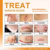 RAVIRANDAL Silicone Scar Sheets, Silicon gel sheets for Scars Transparent Medical Silicone Gel Tape for Scar Removal, Silicone Scar Tape Roll For Hypertrophic Scars and Keloids Caused by Surgery view 2