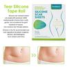 RAVIRANDAL Silicone Scar Sheets, Silicon gel sheets for Scars Transparent Medical Silicone Gel Tape for Scar Removal, Silicone Scar Tape Roll For Hypertrophic Scars and Keloids Caused by Surgery view 4