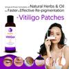 Barphani VitliGon Oil 200ml Super Effective on Vitiligo White Patches, Discolouration, De-Pigmentation, Faster Results, Helps Restricts Spread view 2