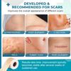 Bonzella Scar Sheets, Silicone Scar Removal Tape for Men and Women, Easy-Tear Soft Scar Removal for Post Surgery & Acne,C-section,Burn,Keloid & Surgical Scar,face,Wrinkles,inner sense Scar Hiding Tape(1.6"x60" Roll) view 3