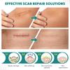 Bonzella Scar Sheets, Silicone Scar Removal Tape for Men and Women, Easy-Tear Soft Scar Removal for Post Surgery & Acne,C-section,Burn,Keloid & Surgical Scar,face,Wrinkles,inner sense Scar Hiding Tape(1.6"x60" Roll) view 4