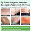 Nexllent Silicone Scar Sheets, Silicon gel sheets for Scars Transparent Medical Silicone Gel Tape for Scar Removal, Silicone Scar Tape Roll For Hypertrophic Scars and Keloids Caused by Surgery view 2