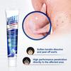 avyaan Warts Remover Ointment Wart Treatment Cream Skin Tag Remover Herbal Extract 7 100 gm view 3