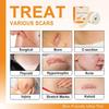 EASTHILL Silicone Scar,Silicone Scar Tape(1.6"x 60" Roll-3M) Effective Scar Removal Sheets, Silicone Scar Removal Sheets for Surgical Scars,Healing Keloid, C-Section, Tummy Tuck (ROLL TYPE) view 2