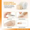 EASTHILL Silicone Scar,Silicone Scar Tape(1.6"x 60" Roll-3M) Effective Scar Removal Sheets, Silicone Scar Removal Sheets for Surgical Scars,Healing Keloid, C-Section, Tummy Tuck (ROLL TYPE) view 3