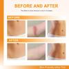 EASTHILL Silicone Scar,Silicone Scar Tape(1.6"x 60" Roll-3M) Effective Scar Removal Sheets, Silicone Scar Removal Sheets for Surgical Scars,Healing Keloid, C-Section, Tummy Tuck (ROLL TYPE) view 4