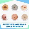Fiasco Tags and Moles Remover Device Natural Effective Scar-Free for Face Skin Care view 3