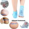 AJUS Silicone Half Heel Protector Socks,Moisturizing for Foot-Care and Heel Cracks,Gel Heel cups Silicon Heel Pad for Heel Ankle Pain,Anti Crack Half Heel Socks (Moisturizing Gel Heel Socks) view 2