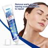 avyaan Warts Remover Cream Extract Skin Face Extract Corn Treatment Ointment Painless For Men Women Childrens (Pack Of 1) view 2