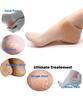 Adornments[2Pcs Combo Of Silicone Gel Pad Soacks+4in1 Pedicure Brush]Silicone Gel Pad Soacks For Antiheel Swelling Pain Relief Cracked Heels & Pedicure Brush Pumice Callus Remover Exfoliator view 3
