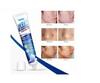 Glamezone Wart Treatment Cream Warts Remover Ointment Skin Tag Removal Men Women Pack of 7 (100 g) view 4