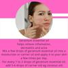 Nhazhoxx Geranium essential oil for skin 15 ml for skin | Beauty oil view 2