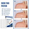 ATORSE Wart Stickers 144 Patches Wart-Removing Sticker Corn Removal Patches, Safe and Gentle on Skin, Wart Removal for Face, Hands, Feet, and Body, Fast-Acting Non-Irritating view 3