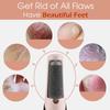 ROITIX Flewless Pedi Electronic Pedicure Tool Cordless Rechargeable Callus Dead Skin Remover Polishing Wand (Flewless pedi) view 2