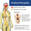 Peripheral neuropathy legs and feet pain relieve immediately by Neurons natural view 3