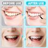 MAPVOLUT 120 PCS Black and White Interdental Brush view 3