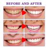 Bnf Purple Toothpaste for Sensitive Teeth 30ml Reduce Yellowing Brightening|Health & Beauty | Oral Care | Whitening view 4