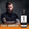 Nutrionz Organic Beard Growth Oil for Beard and Moustache Oil, 30 ml | Beard Oil for men | Non-Sticky, Light | Almond Oil, Aloe vera, Vitamin E | Shiny Nourished Beard Growth with derma roller 0.5 mm view 3