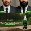 Sheopals Beard & Hair Growth Oil for Men | Rosemary & Kalonji Infused | Boosts Beard Density & Hair Thickness Promotes Thicker, Healthier Beard Growth | Ayurvedic, Non-Sticky & Natural Formula  50 ml view 4