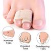 ADBEE | Toe Straightener & Bunion Corrector for Pain Relief | 2 Pcs Orthopedic Toe Splints with Separator | Adjustable | Beige | Unisex view 4