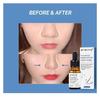 ARMM Products Nose Oil - Natural Essential Oil for Nose Firming Essential Oil Massage Oil Nasal Bone for Remodeling Slimming and Shaping-30ml view 4