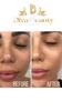 Avocado Night cream + Day Cream | Brightning Face cream | For Dark Spots, Uneven Skin Tone, Removes Pigmentation, Removes Pimples | (Night cream + Day Cream with Korean Glow capsule) view 3