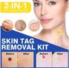 Auto Skin Tag Remover Kit, 2 in 1 Skin Tag Remover, Skin Tag Removal Kit for Removing Small to Medium view 4