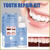 Tooth Repair Kit, Temporary Teeth Gap Repair Kit, Temporary Teeth Replacement Kit, Tooth Repair Shaping Teether Kit view 2