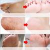 ADBHUTANAND Foot Peeling Mask For Dead Skin Removal Natural Exfoliator For Dry Dead Skin,Callus,Peeling Foot Mask Repairs Heels&Removes Cracked Feet&Rough Heels Enjoy Baby Soft Smooth Feet,1 Count view 4