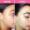 Face Razor Women Facial Hair | Eyebrow Painless Removal for Women | Facial Razors for Women | Face Shaver for Women Facial Hair or Ladies Bikini Area | (3) view 4