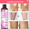 INTIMIFY Hair Removal Powder | For Underarms, Bikini Area & Intimate Area | 2 Min Full Body Hair Removal For Men & Women view 3
