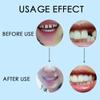 MERISHOPP Dental Thermal Beads Teeth Veneers Moldable Denture Temporary Tooth Repair 25g|Health & Beauty | Oral Care | Denture Care|1X Tooth Repair Kit view 2