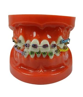 NMD Dental Ortho Model With Implants
