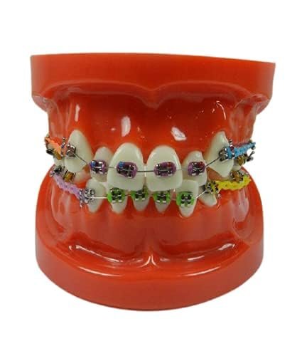 NMD Dental Ortho Model With Implants