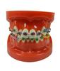 NMD Dental Ortho Model With Implants view 1