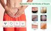 mygezi Silicone Scar Sheets, Silicon gel sheets for Scars Transparent Medical Silicone Gel Tape for Scar Removal, Silicone Scar Tape Roll For Hypertrophic Scars and Keloids Caused by Surgery view 2