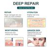 mygezi Silicone Scar Sheets, Silicon gel sheets for Scars Transparent Medical Silicone Gel Tape for Scar Removal, Silicone Scar Tape Roll For Hypertrophic Scars and Keloids Caused by Surgery view 3