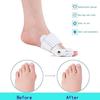 Onmall Bunion Corrector for Women Men, Orthopaedic Toe Straightener Splint with Fracture Support and Pain Relief, Adjustable Design for Right/Left Foot Alignment view 2