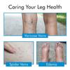 Cotton Medical Compression Stockings for Varicose Veins Class 2 Knee Length for men and women| Compression Socks | stockings for women | Varicose Vein Stockings -Thigh Length(Stockings-9-S) view 3