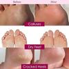 ADBHUTANAND Peeling & Exfoliating Foot Mask for Baby Soft Feet Hydrates Feet Peeling Mask for Removes Dry Dead Skin,Cracked Heels &Calluses Natural Exfoliator for Men and Women (rose),1 Count view 4