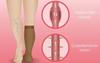 CLINICA CARE Cotton Medical Compression Stockings for Varicose Veins Class 2 Knee Length for men and women| Stockings for women | Stockings -Thigh Length(CC-Stockings-8-L) view 2